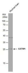 GSTM1 antibody