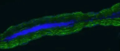 Creatine kinase (muscle) antib