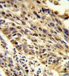 TRIP13 antibody, N-term