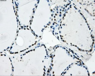 LOX antibody [6B11]