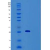 人TRAIL R3/TNFRSF10C/CD263重组蛋白C-6His