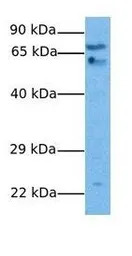 GABA A Receptor theta antibody