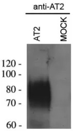 AGTR2 antibody