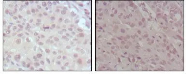 MLL antibody [10F8D7]