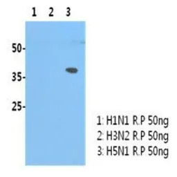 Avian Influenza A virus H5N1 H
