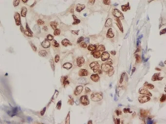 Progesterone Receptor antibody