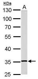 RPL5 antibody