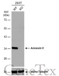 Annexin V antibody [N2C3]