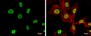 Histone H4K5K8K12K16ac (acetyl