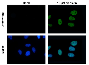 Histone H2A.XS139ph (phospho S