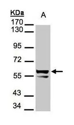 Cytokeratin 6 antibody
