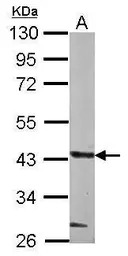 GLT8D1 antibody