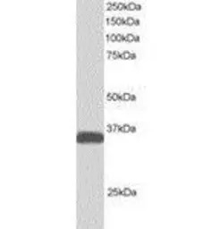 ALS2CR2 antibody