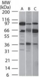 SIRT5 antibody