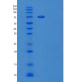 人β-半乳糖苷酶/GLB1重组蛋白C-6His