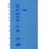 人β-半乳糖苷酶/GLB1重组蛋白C-6His