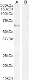 FOXC2 antibody, C-term