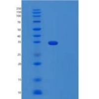 人L选择素(SELL)重组蛋白