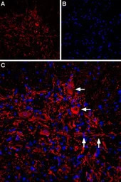 IP3 Receptor II antibody