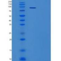 人补体因子B/CFB重组蛋白C-6His