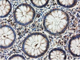 HDAC6 antibody [4C5]