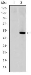 MMP1 antibody [6A5]