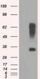 RNF144B antibody [11F4]