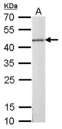Citrate synthase antibody [GT2