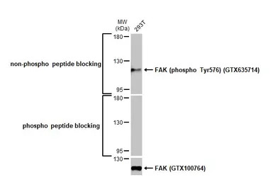 FAK antibody