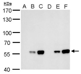 Carbonic Anhydrase IX antibody