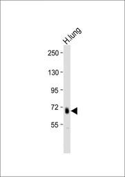 ADAMTS4 antibody, C-term