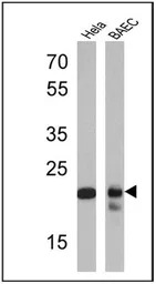 PSMB6 antibody