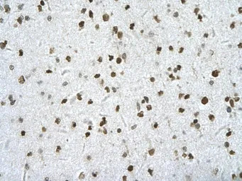 HIPK2 antibody, Internal