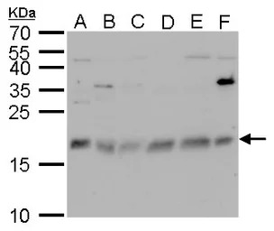 CHAC2 antibody