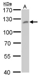 O-GlcNAc transferase antibody 