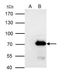 PRMT3 antibody