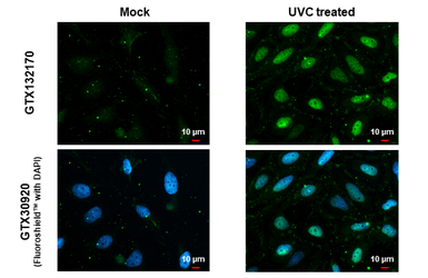 Chk1 (phospho Ser317) antibody