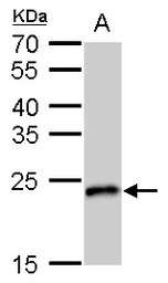 SOD2 antibody [GT17112]