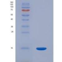 人酰基磷酸酶1，红细胞重组蛋白ACYP1