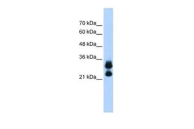 Histone H1.2 antibody, Interna