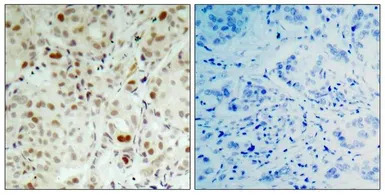 Rb (phospho Ser807) antibody