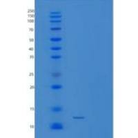 人硫氧化还原蛋白(Trx)重组蛋白