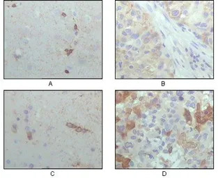 alpha B Crystallin antibody [1