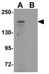 ATP2C1 antibody