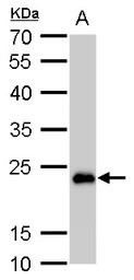 SOD2 antibody [GT17112]