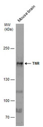 TNR antibody [C1C2], Internal