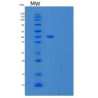人骨形态发生蛋白受体ⅱ/BMPR2/PP h1重组蛋白C-Fc-6His