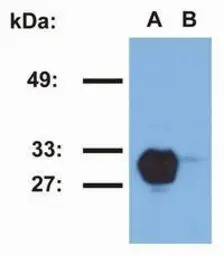HLA-DR1 antibody [MEM-267] (PE