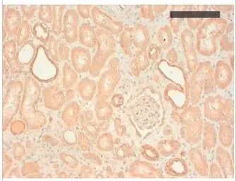 basic Cytokeratin antibody [AE