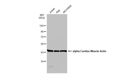 alpha Cardiac Muscle Actin ant